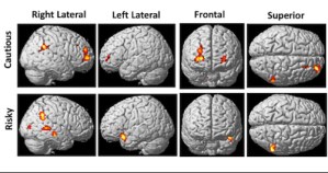 Teen brain images.jpg